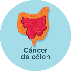 Colon