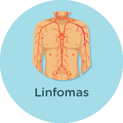 Linfomas